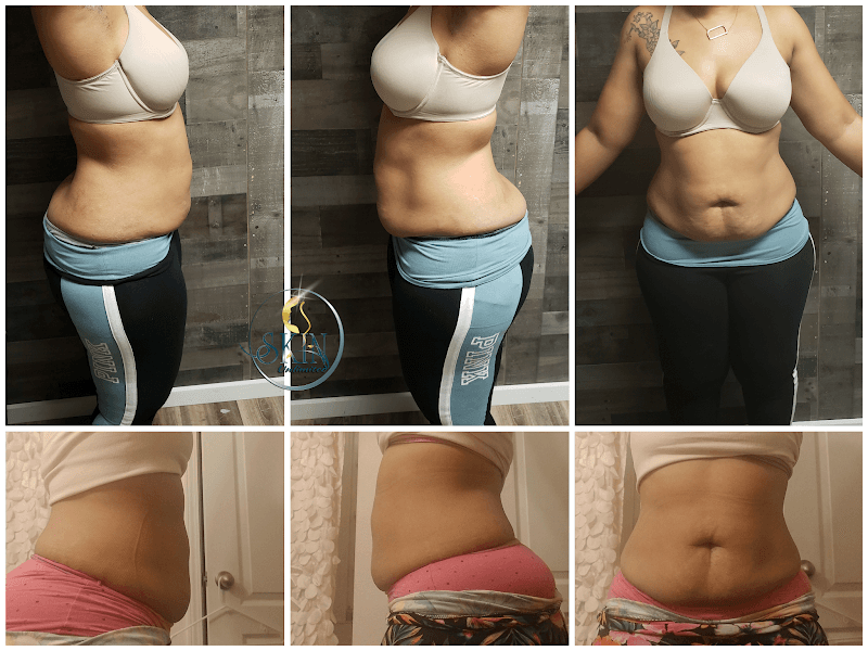 Skin Unlimited Jacksonville photo