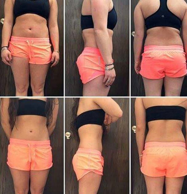 Skin Up, Aesthetic Medicine Cuajimalpa de Morelos photo