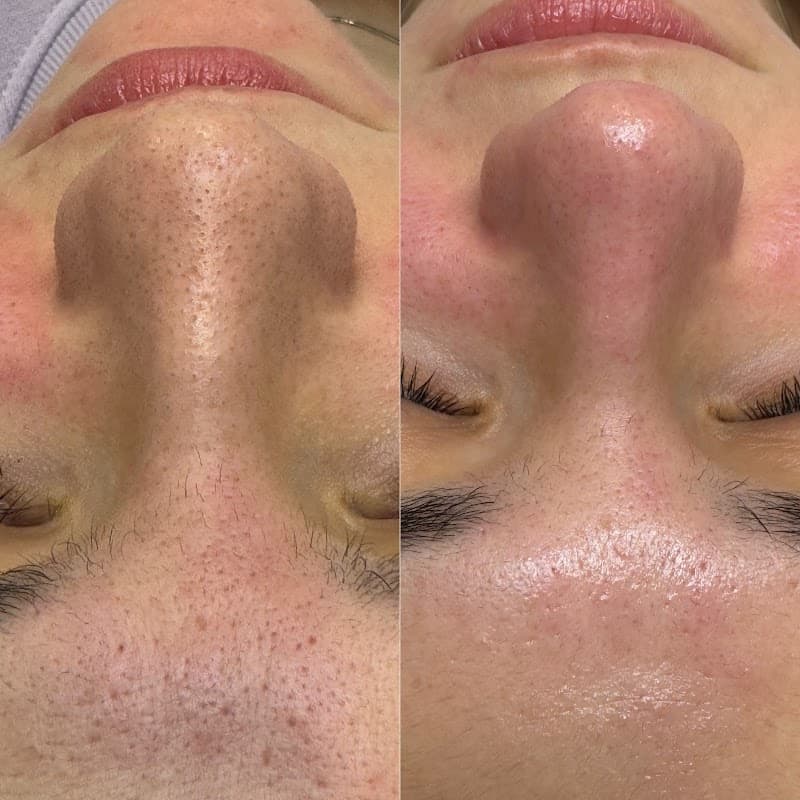 Skincare by Avi Galați photo