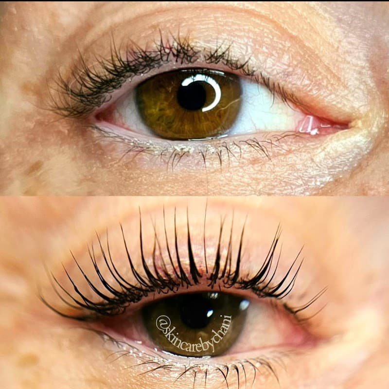 Skincare by Chani Newton photo