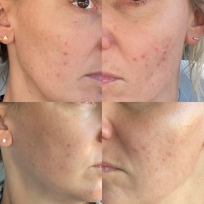 Skincare By Olga Lovett San Francisco photo