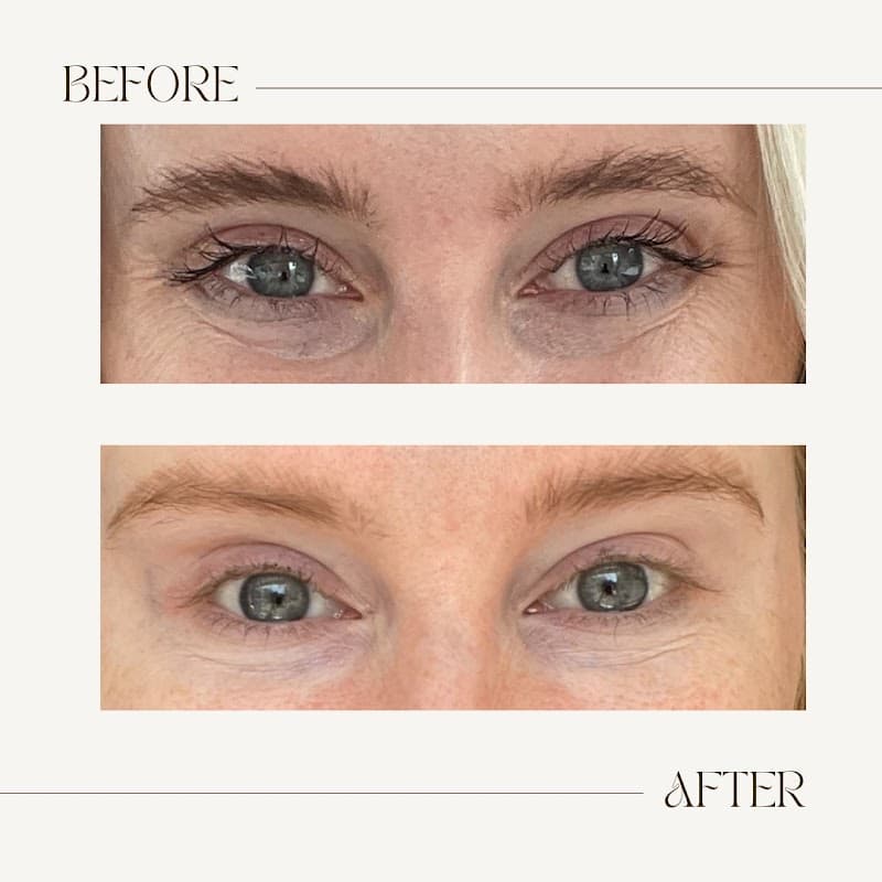 Skinluxe Medical Aesthetics Bloomington photo