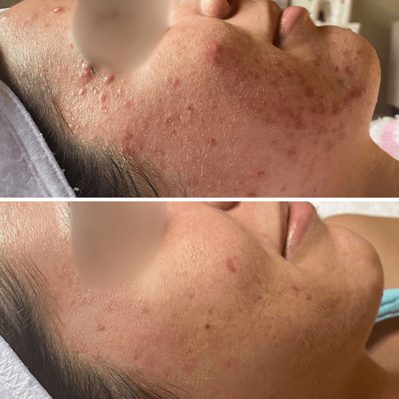 Skintuition Skincare Boutique Pewee Valley photo