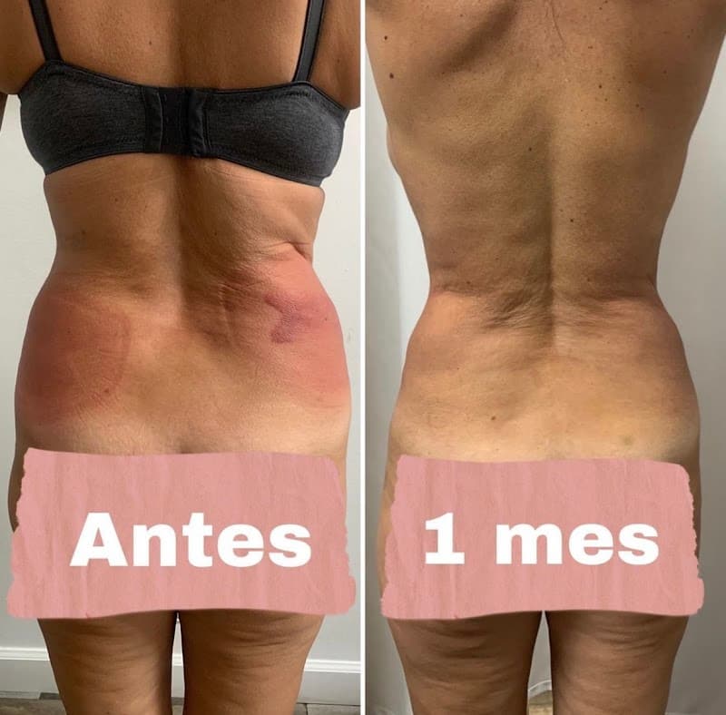 Slim Body Center West Palm Beach photo