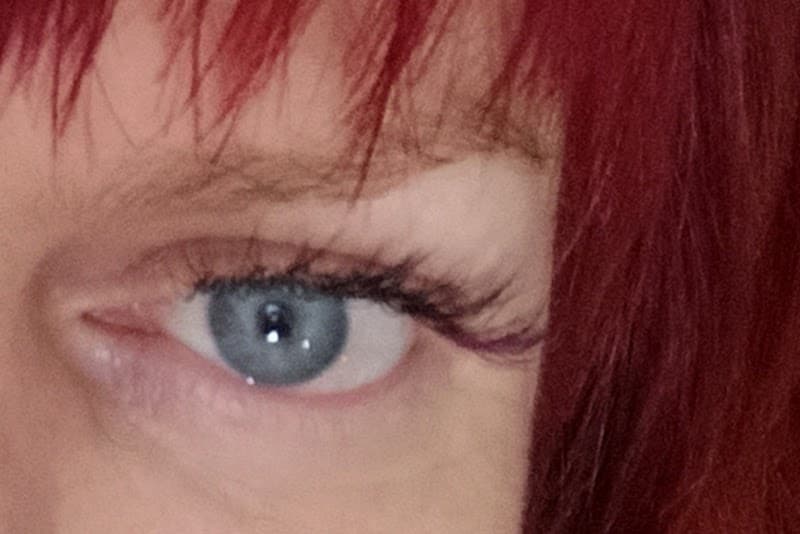 Slim Line - Institute of Aesthetics Athens photo