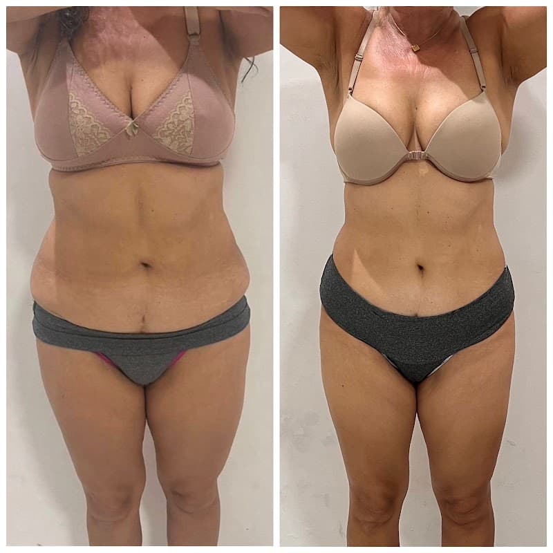 SLS Clinica de Estética Belo Horizonte photo