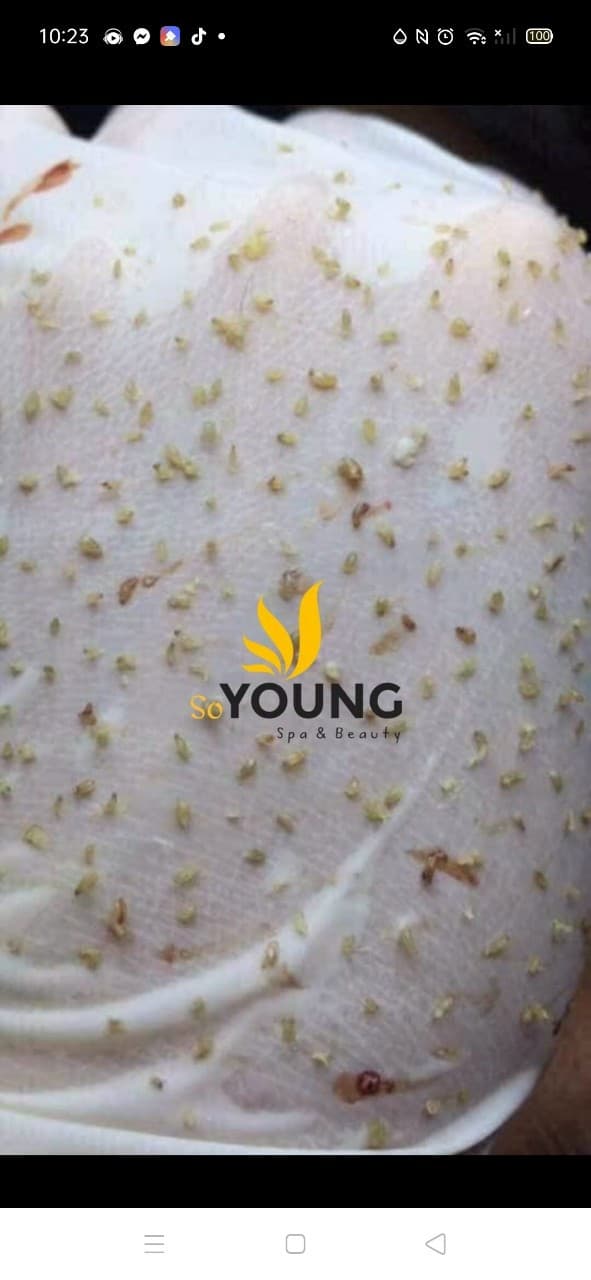 Soyoung Spa Quận 1 photo