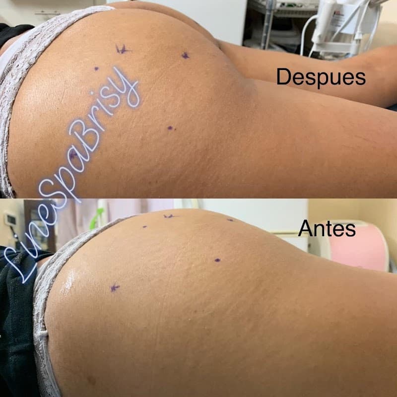 Spa brisy Armería photo
