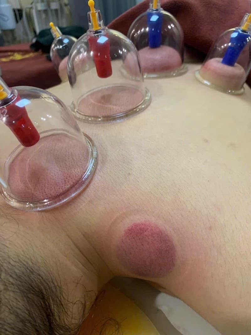 Spa Halinh gội đầu dưỡng - massa body - mụn Vĩnh Yên photo