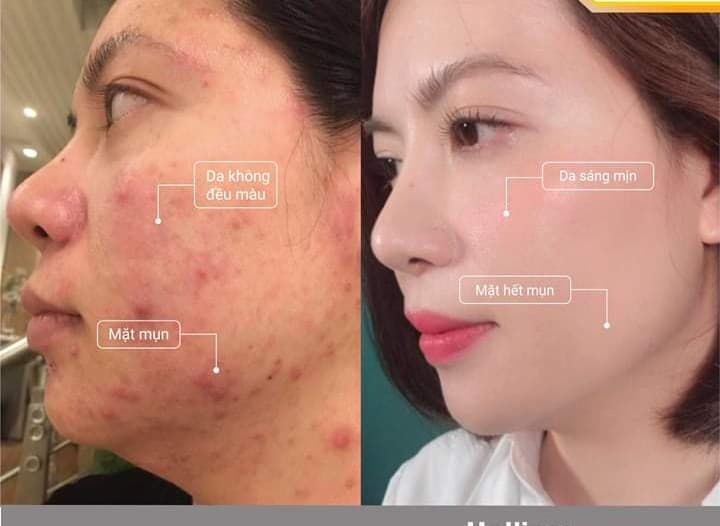 Spa hương olever Huyện Thanh Oai photo