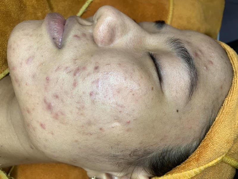 Spa Lê Na Cam Ranh photo