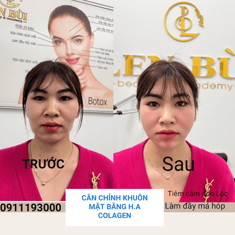 Spa Len Bùi Thị Xã Mỹ Hào photo