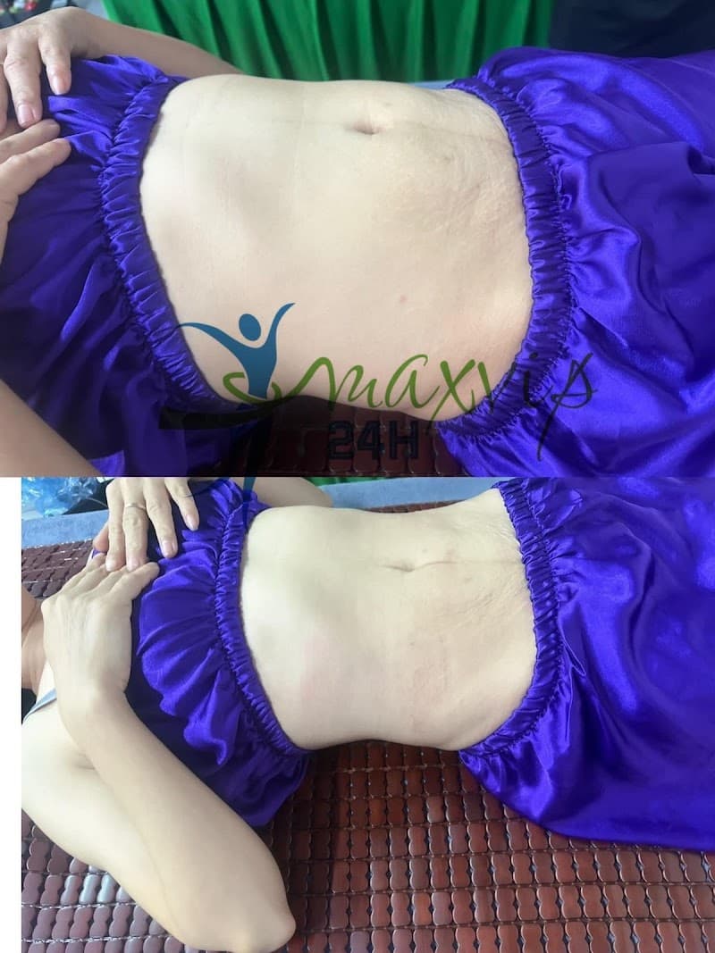 Spa Tuyết Ngân Thái Nguyên photo