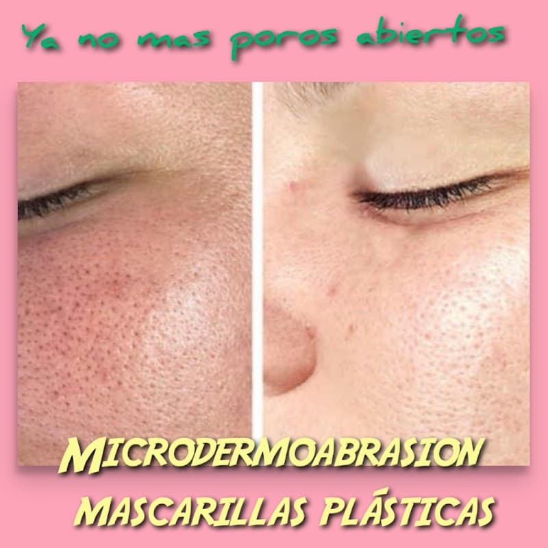 SPA yanetica Coatzintla photo