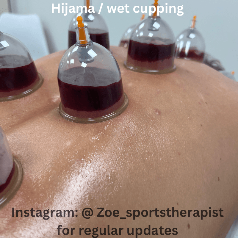 Sports Massage Therapy by Wayne Peterborough photo