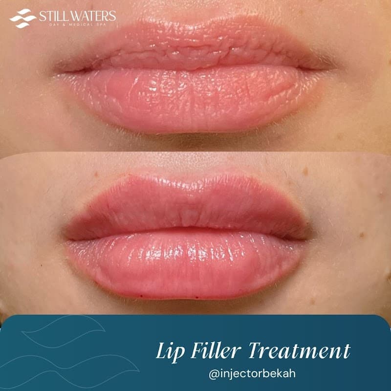 Still Waters Natural Wellness Spa Greenwood photo