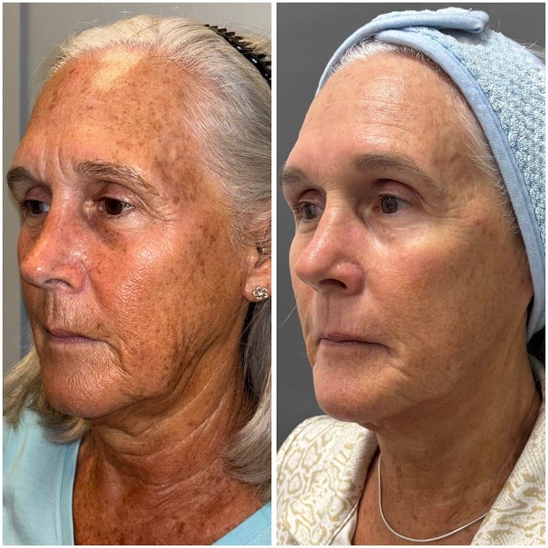 Sublime Spa Treatments Bonita Springs photo