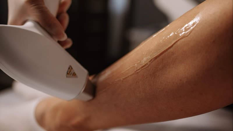 Sugaring Zaporizhzhia photo