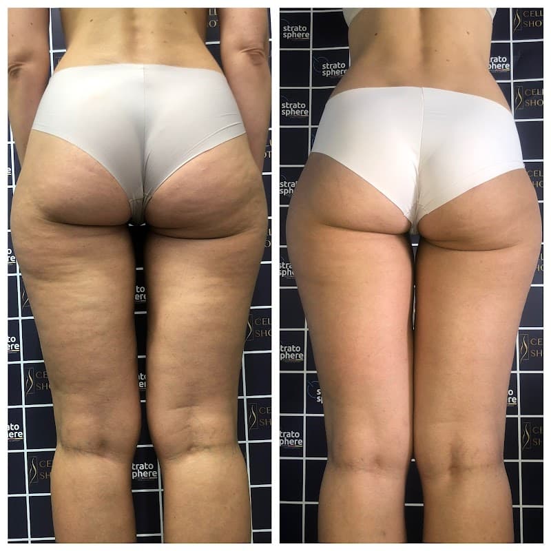 Surtep massage Liuteranska St photo