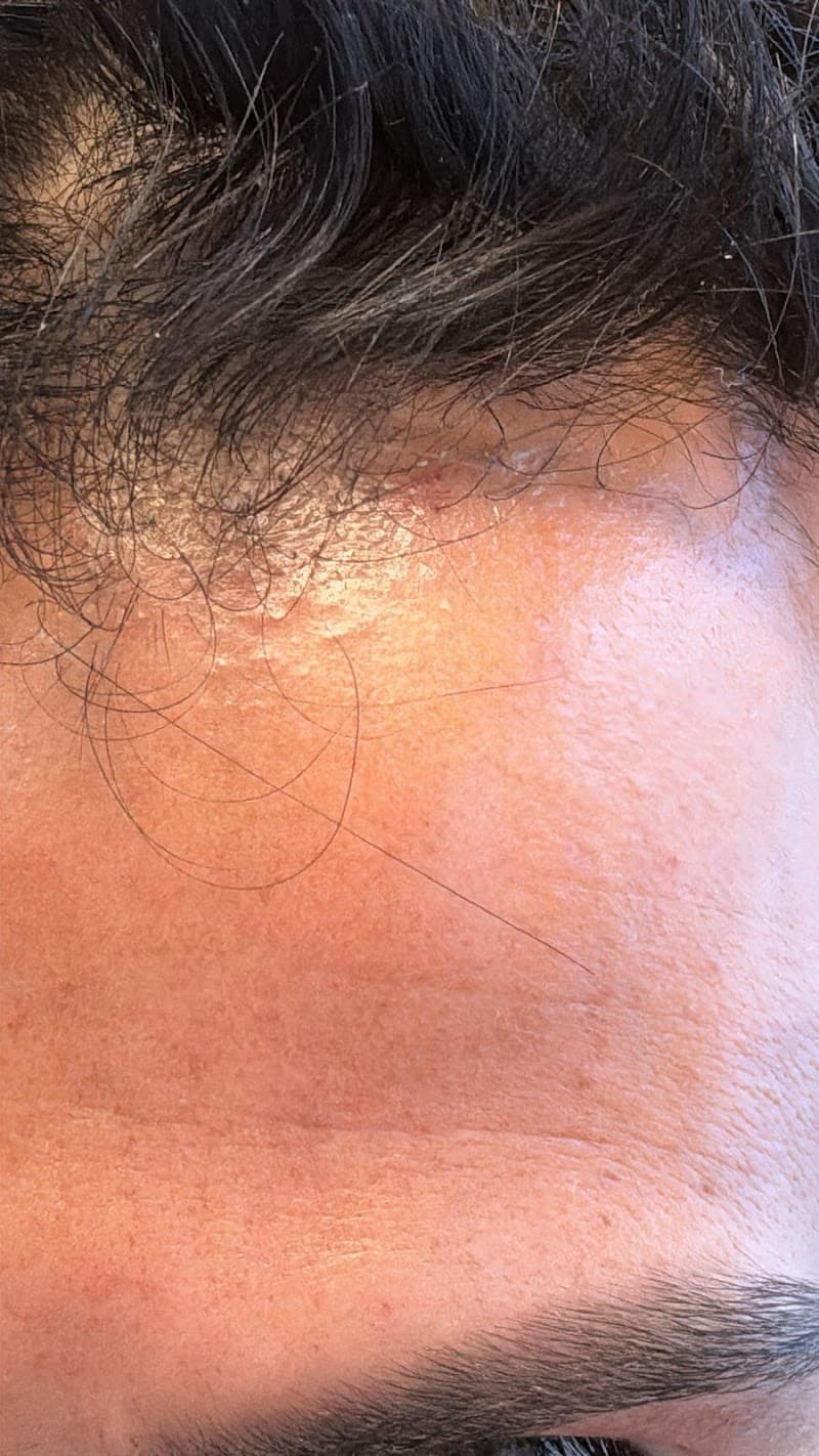 Sussol Skin Care Center Union City photo