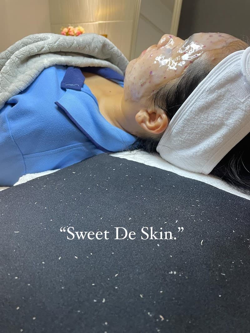 Sweet De Skin Facial Detox and Acne Massage Chiang Mai photo