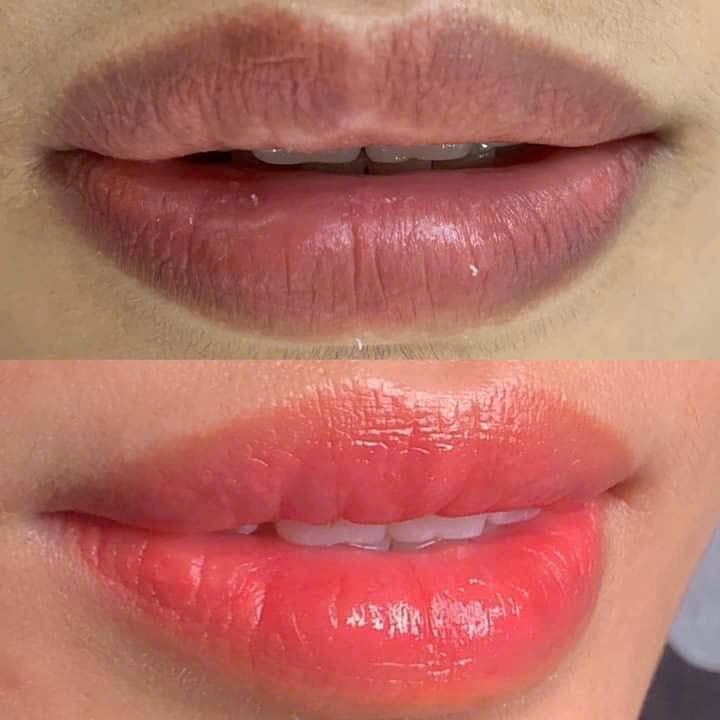 Talent Spa Beauty and Clinic Dĩ An photo