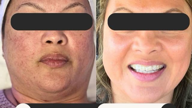 Tam's Glam Spa Scales Mound photo