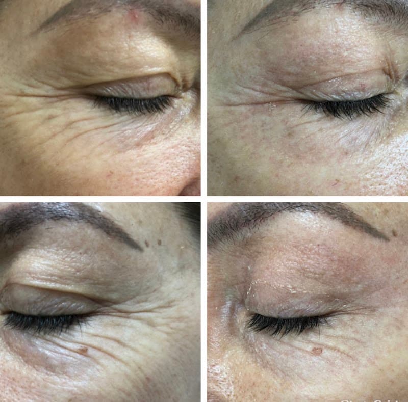 Tássia Giarola - Estética Facial e Corporal Tombos photo