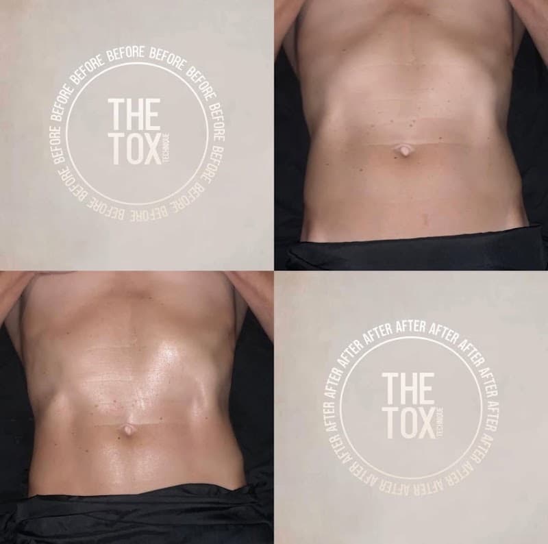 TCK Clinical Shiatsu Chesterfield photo