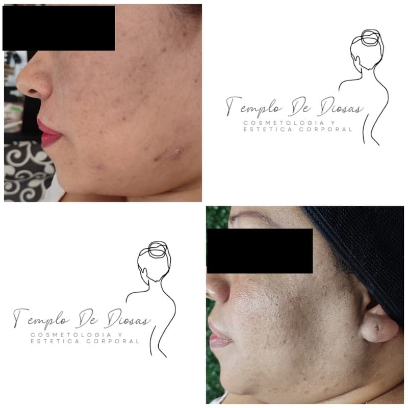 Templo De Diosas Body Perfect Morelia photo