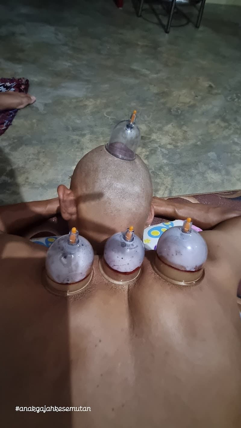 Terapi Bekam dan Kebugaran Bantul photo