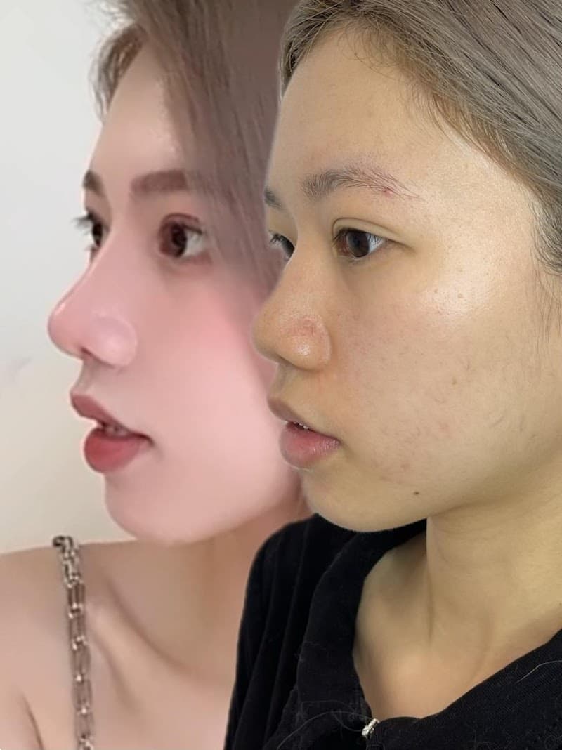 Teriwei Body Slimming Centre Butterworth photo