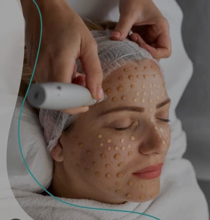 Tesla Spa Ojo de Agua photo