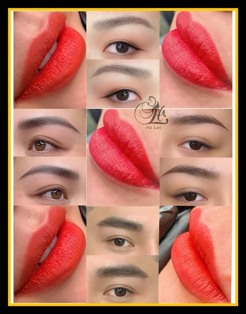 Thẩm Mỹ Hà Lan Huyện Hóc Môn photo