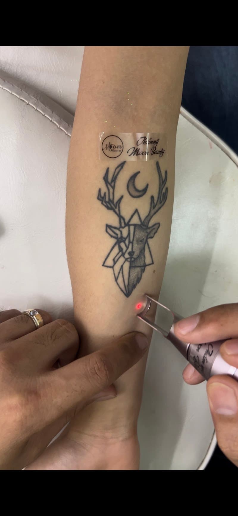 Thẩm Mỹ Moon Beauty CS1 Quận Cầu Giấy photo