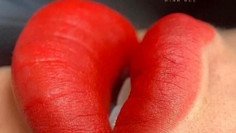 Thẩm Mỹ Quốc Tế Kangnam Huyện Nhơn Trạch photo