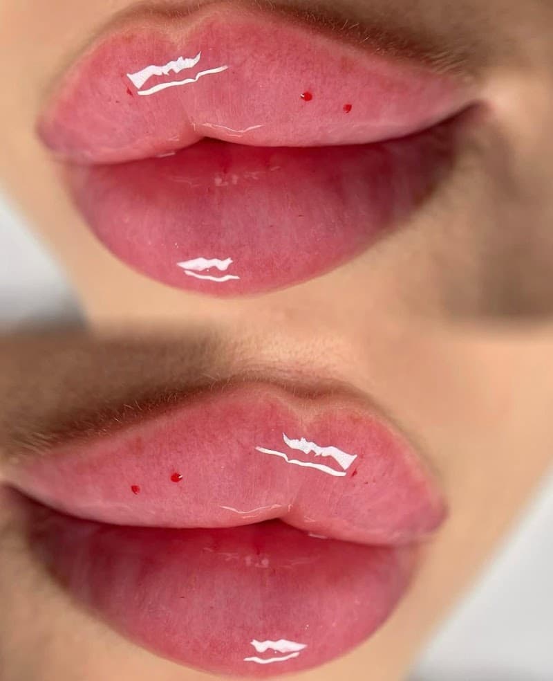 Thẩm Mỹ Viện Cathryn Thị Xã Trảng Bàng photo