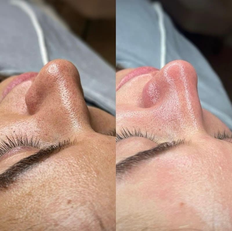 ThẢO My Spa Quận Thanh Khê photo