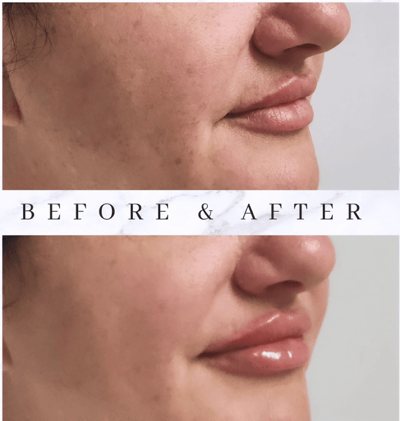 The Aesthetics Studio Shelby Township photo