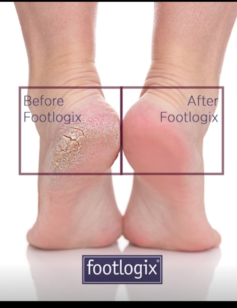 The relaxology co. Doncaster photo