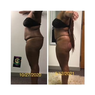 Thuya Body Institute High Point photo