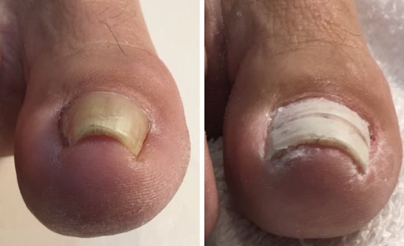 Toenail Masters Calgary photo