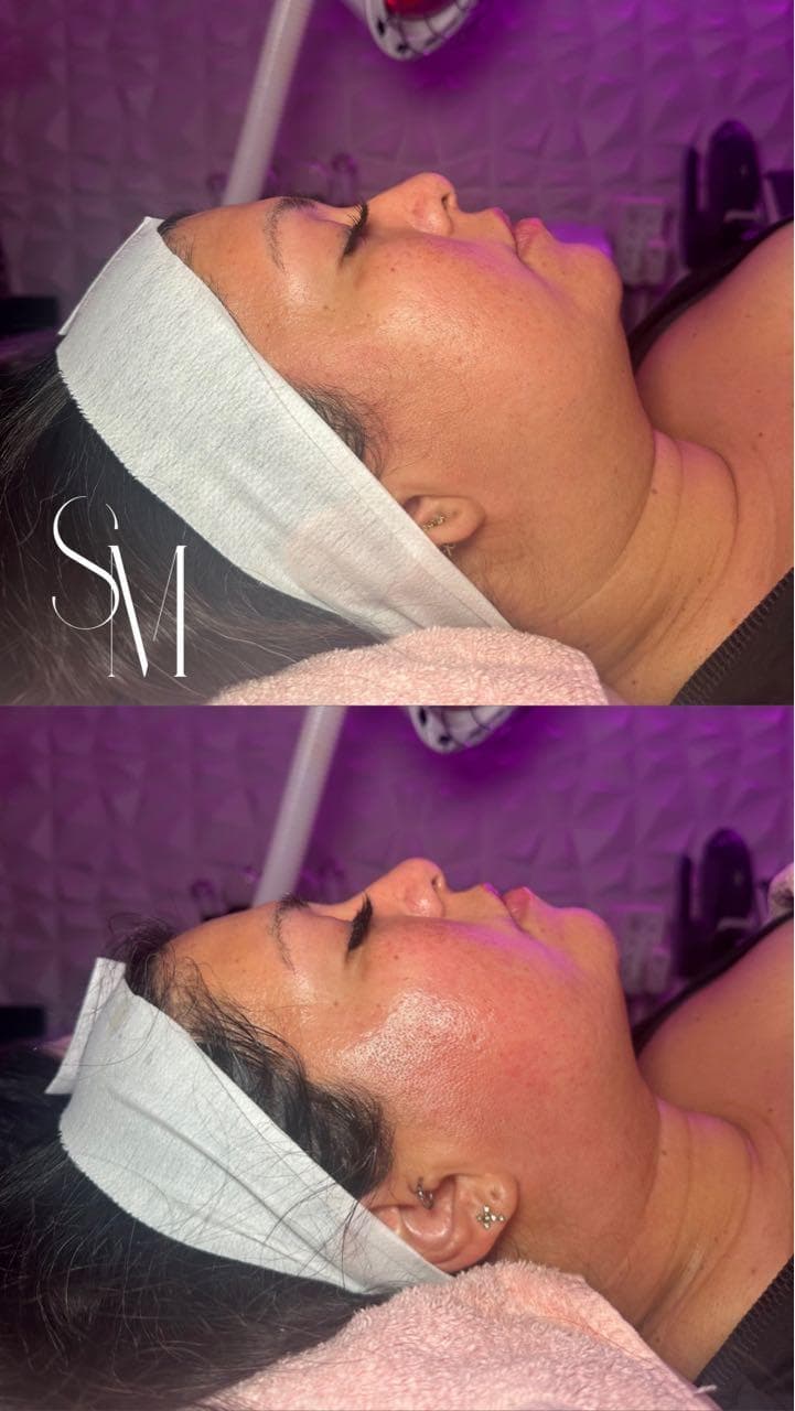 Top Notch Body Contouring and Spa Houston photo