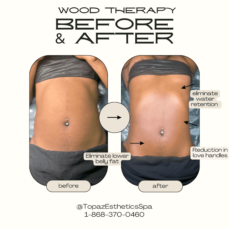 Topaz Esthetics Spa Couva-Tabaquite-Taiparo photo