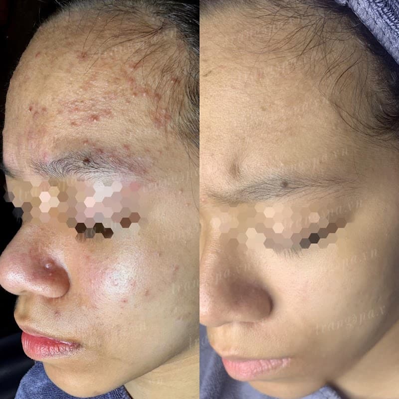 Trang Tây Beauty Spa Quận Long Biên photo