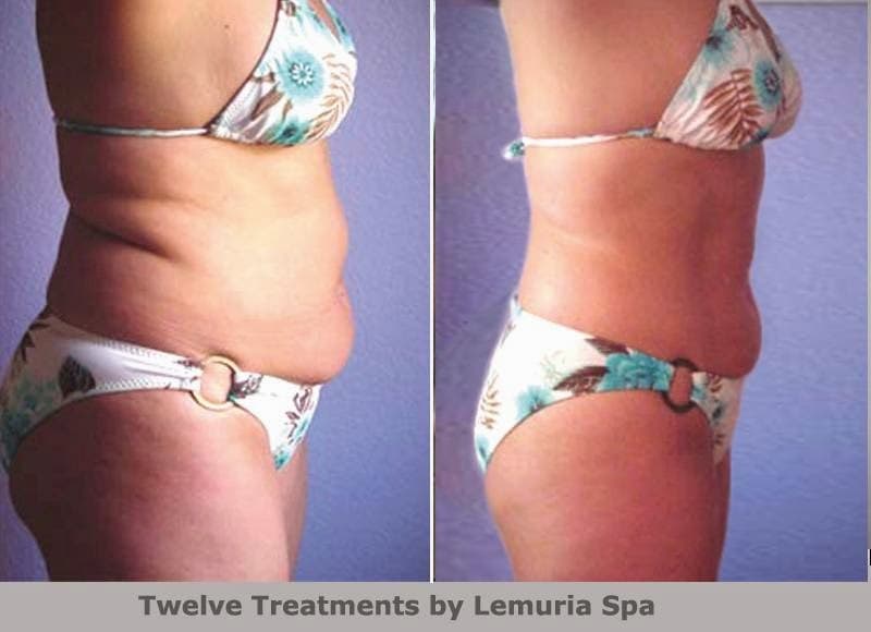 Transformation Clinics Springfield photo