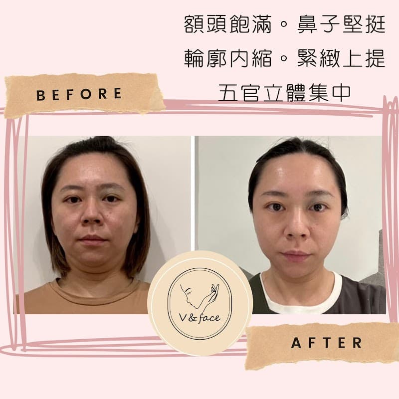 V&Face Small Face Beauty Taipei City photo