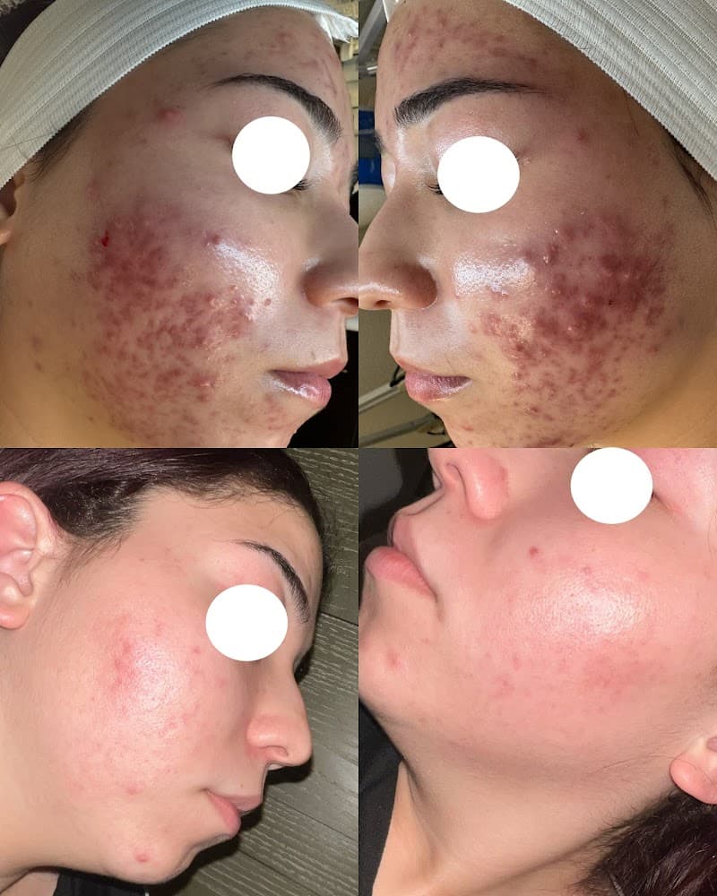V Skincare Apopka photo