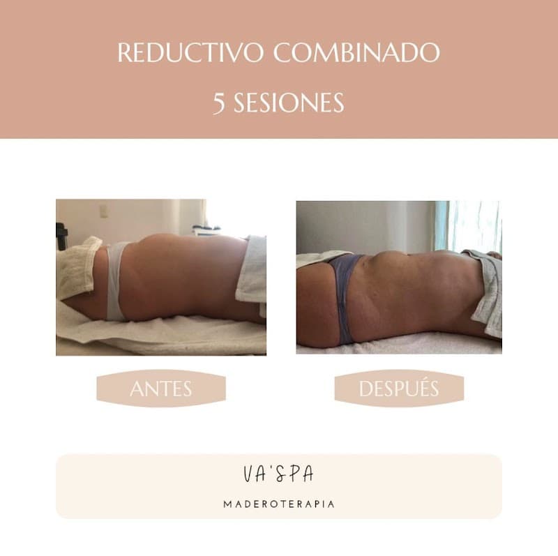 Va'spa Maderoterapia Mérida photo
