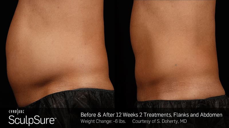 Vada Spa and Laser Center New York photo